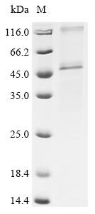 Sarcoplasmic/endoplasmic reticulum calcium ATPase 1 (ATP2A1), partial, human, recombinant