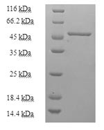 Purine nucleoside phosphorylase (PNP), human, recombinant