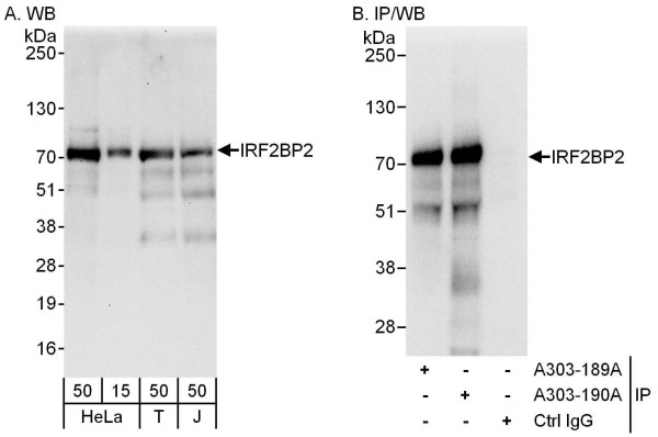 Anti-IRF2BP2