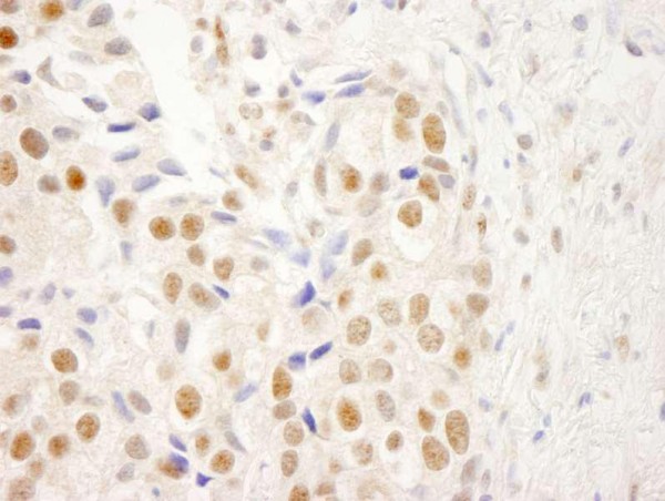 Anti-NRBF2 (IHC)