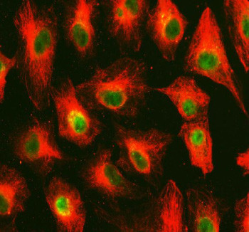 Anti-OMA1 / Overlapping with the m-AAA protease 1