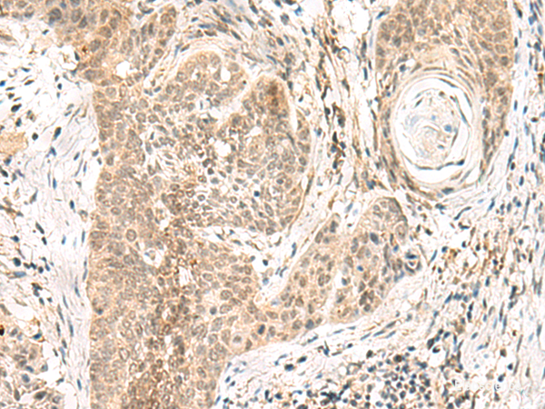 Anti-GPSM1