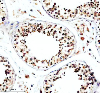 Anti-TFDP3 / Transcription factor Dp family member 3