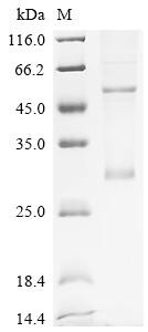 Ras-related protein Rab-33A (RAB33A), recombinant human