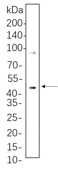 Anti-Recombinant Phospho-MEK1/2 (Ser217/221), clone 9C8