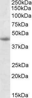 Anti-GNAS, Internal