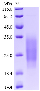 Single Ig IL-1-related receptor (SIGIRR), partial, human, recombinant