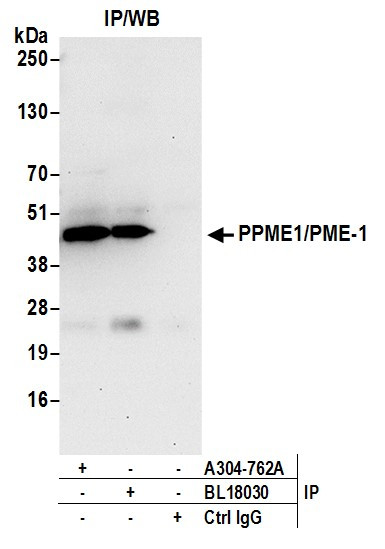 Anti-PPME1/PME-1
