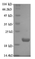 Protein prune homolog (PRUNE), human, recombinant