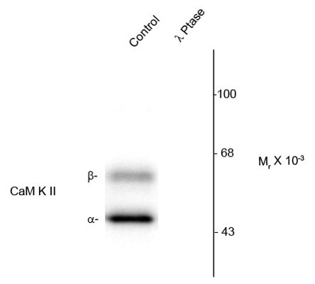 Anti-phospho-CaMKII (Thr286)