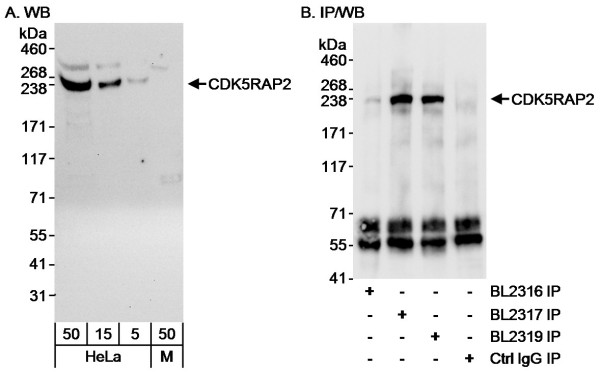Anti-CDK5RAP2