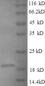 Single-stranded DNA-binding protein (ssb), Bacillus anthracis, recombinant