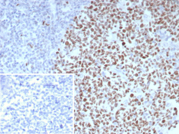 Anti-Bcl-6 (Follicular Lymphoma Marker), recombinant antibody, clone BCL6/8983R