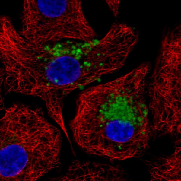 Anti-MUC5B