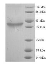 Hyaluronan synthase 2 (Has2), partial, mouse, recombinant