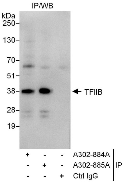 Anti-GTF2B/TFIIB