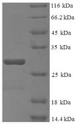 DNA-directed RNA polymerase III subunit RPC10 (POLR3K), human, recombinant