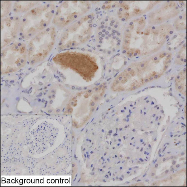 Anti-Interferon gamma