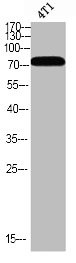 Anti-Phospho-BMX (Y566)