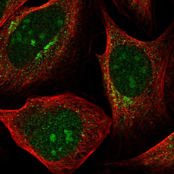 Anti-PDK1