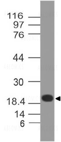 Anti-ZIKA Envelope protein (Clone: ABM54D4)