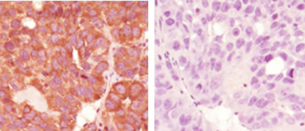 Anti-KHK (isoform A)