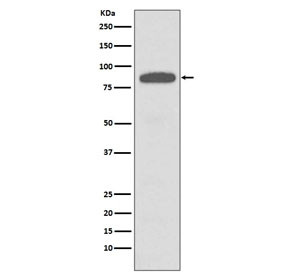 Anti-IKK alpha/beta, clone FCC-3