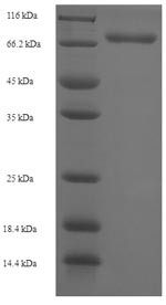 Diphthamide biosynthesis protein 2 (DPH2), human, recombinant