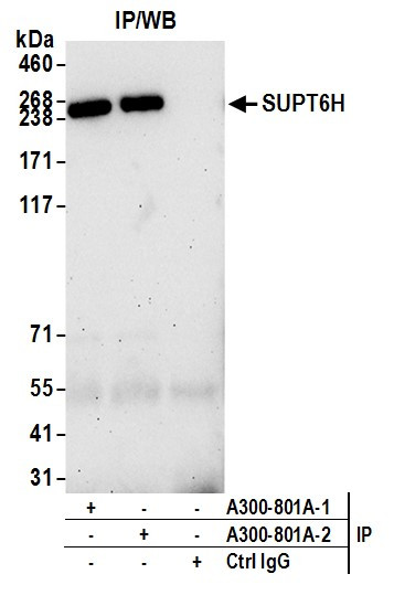 Anti-SUPT6H