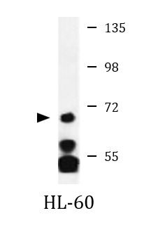 Anti-KMT2E / MLL5