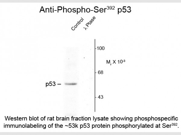 Anti-phospho-p53 (Ser392)