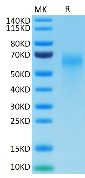 Cynomolgus IL-2 R gamma/CD132 Protein