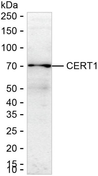 Anti-CERT1