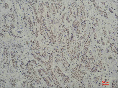 Anti-TBP Monoclonal