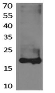 Anti-Lipocalin-1