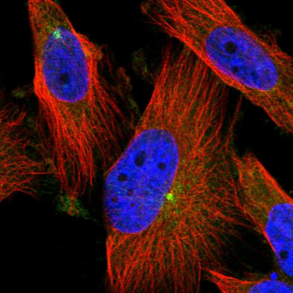 Anti-PCYT2