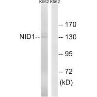 Anti-NID1