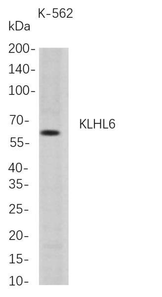 Anti-Recombinant KLHL6, clone 9D7
