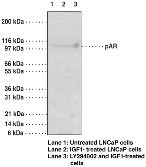 Anti-Androgen Receptor (Phospho-Ser210,213) (Clone 156C135.2)