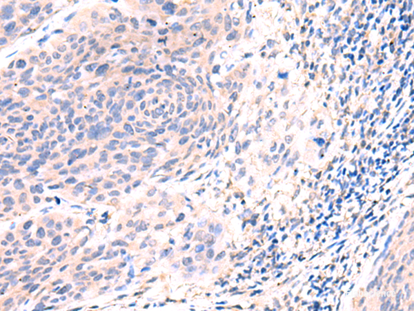 Anti-ESM1