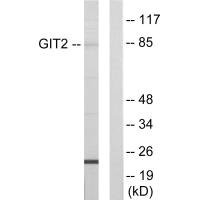 Anti-GIT2