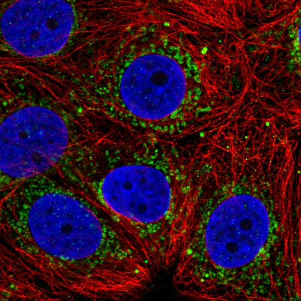 Anti-ALDH6A1