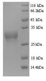 Omega-gliadin, partial, Triticum monococcum, recombinant