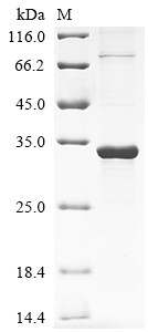 Protein RRP5 homolog (PDCD11), partial, human, recombinant