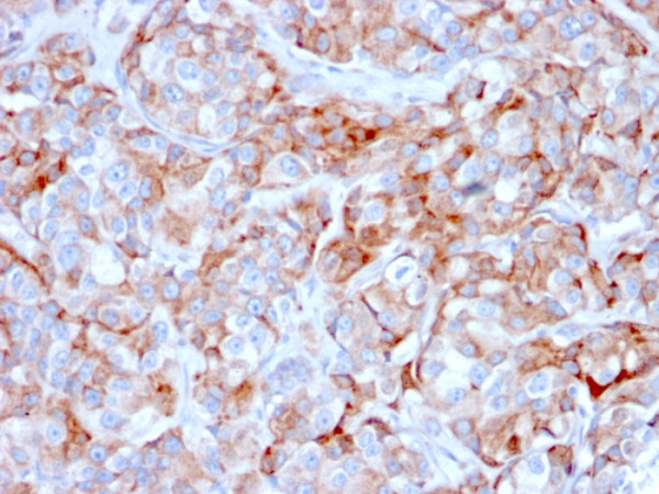 Anti-CD269 / TNFRSF17 / BCMA (B-Cell Maturation Protein), clone BCMA/2366