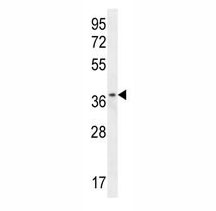 Anti-ZNF322B