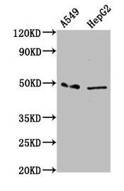 Anti-MFSD4A
