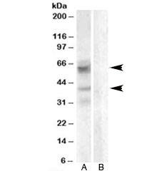 Anti-Arylsulfatase D