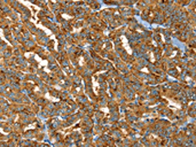 Anti-PTPN3