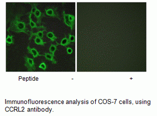 Anti-CCRL2